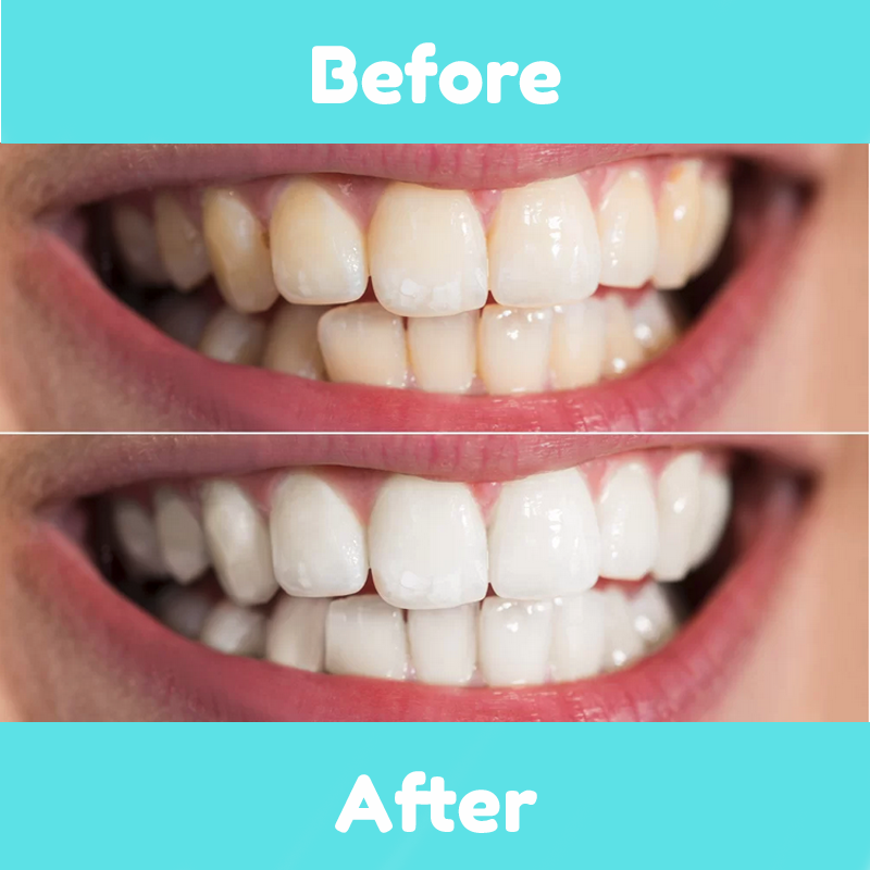 ORAL MAX - Mild Whitening Foam Toothpaste